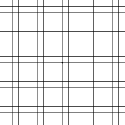 Amsler Grid Chart to Test for Macular Degeneration