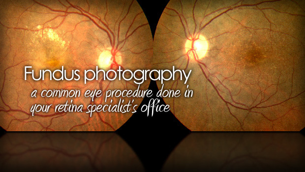 Fundus Photography Is Used To Photograph Inside The Eye