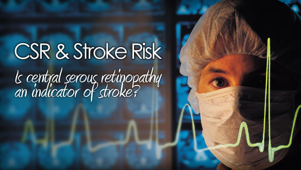 CSR and stroke risk