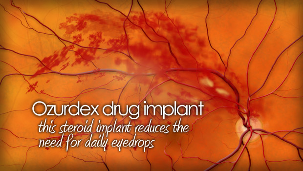 Ozurdex implant for retinal vein occlusion