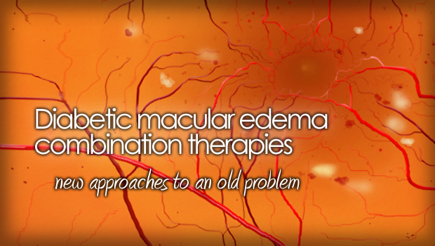 Diabetic macular edema pic