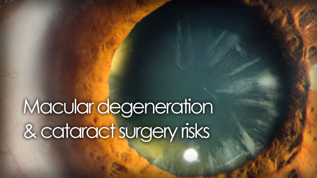 Patients with AMD can have cataract surgery